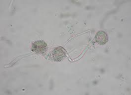 Aspergillus versicolor